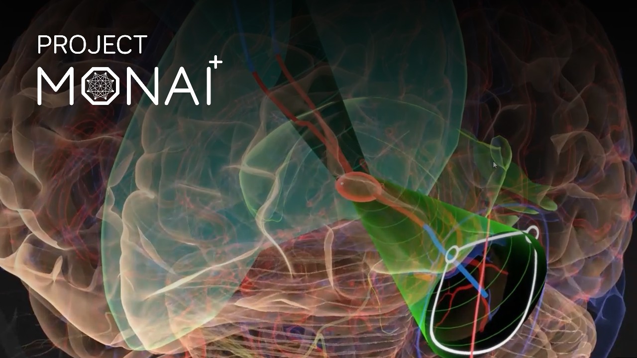 Learn more about NVIDIA MONAI